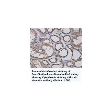Vimentin Antibody
