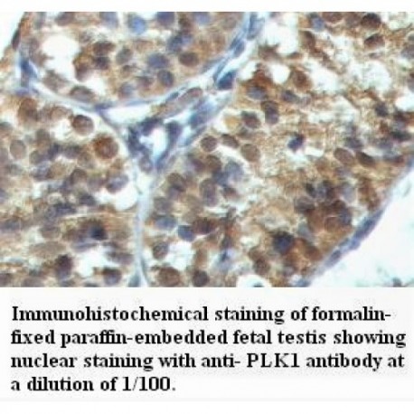 PLK1 Antibody