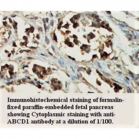 ABCD1 Antibody