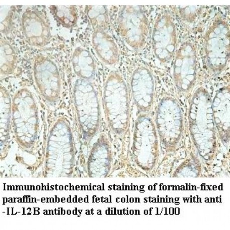 Fas Antibody