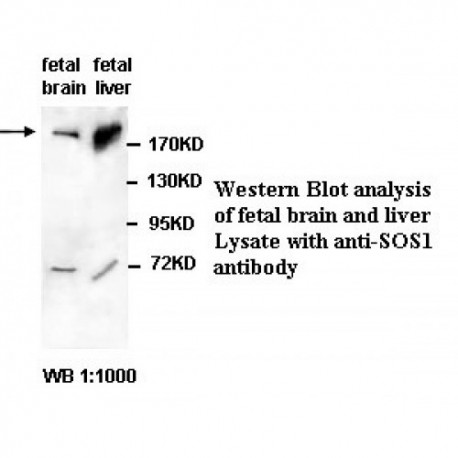 SOS1 Antibody