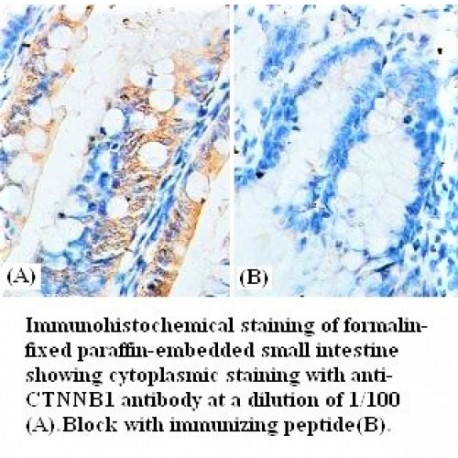 CTNNB1 Antibody