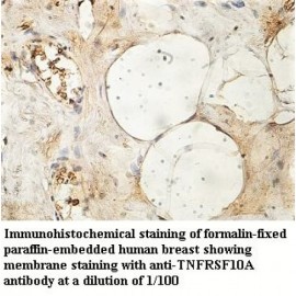 TNFRSF10A Antibody