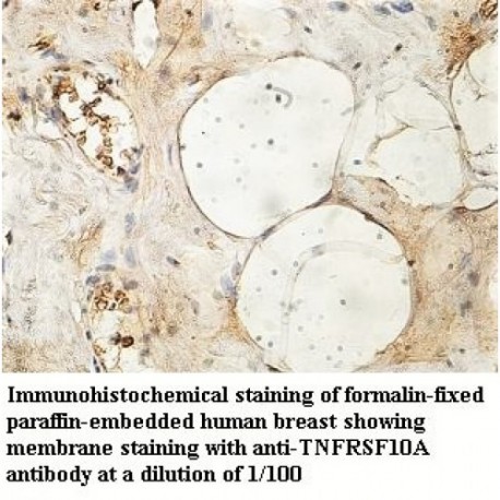 TNFRSF10A Antibody