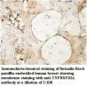 TNFRSF10A Antibody