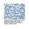 TNFRSF13B Antibody
