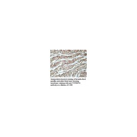 TNFRSF21 Antibody