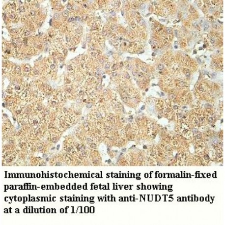 NUDT5 Antibody