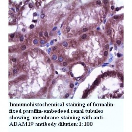 ADAM19 Antibody