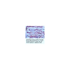 TRAIL Antibody