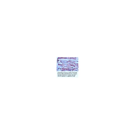 TRAIL Antibody