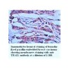 TRAIL Antibody
