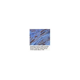 TNNI1 Antibody