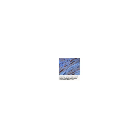 TNNI1 Antibody