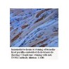 TNNI1 Antibody