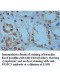 PSMC3 Antibody