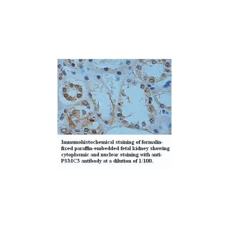 PSMC3 Antibody