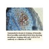 AADACL4Antibody