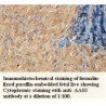  AADACL4Antibody
