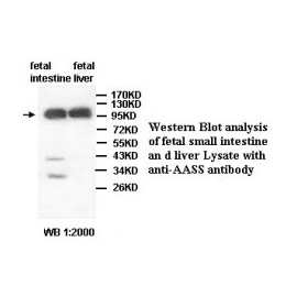  AADACL4Antibody