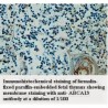 ABCA13 Antibody