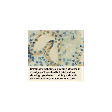 ACSM4 Antibody