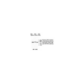 ACTR5 Antibody