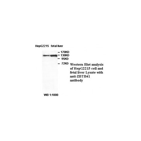 ZBTB34 Antibody