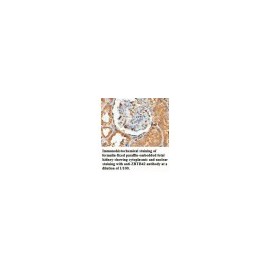 ZBTB42 Antibody