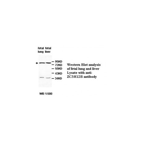 ZC3H12B Antibody