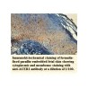 ACER1 Antibody