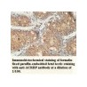 ACRBP Antibody