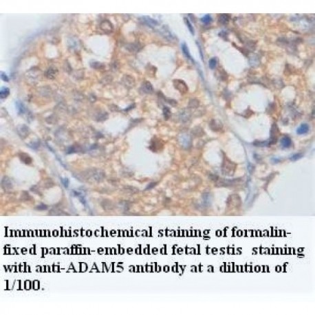 ADAM5 Antibody