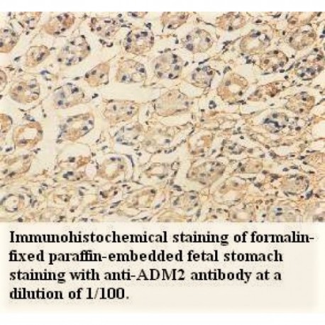 ADM2 Antibody