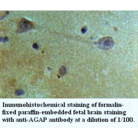 AGAP4 Antibody