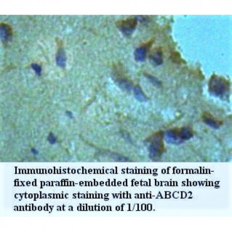 ABCD2 Antibody