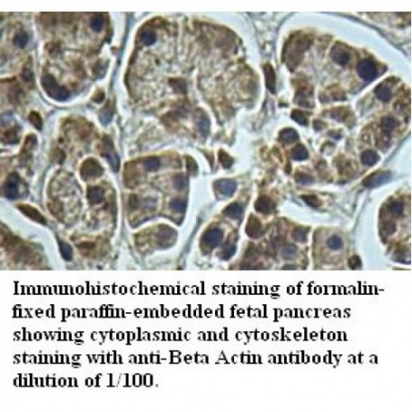 Beta Actin Antibody