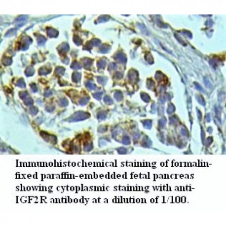 IGF2R Antibody