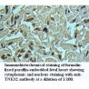 TNKS2 Antibody