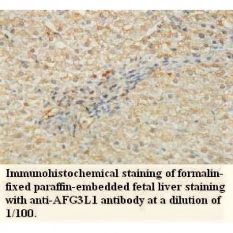 TRIM3 Antibody