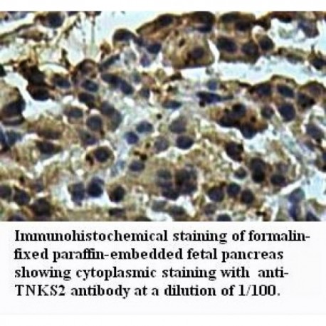 ABCB1 Antibody