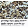 TNKS2 Antibody
