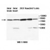 TRIM3 Antibody