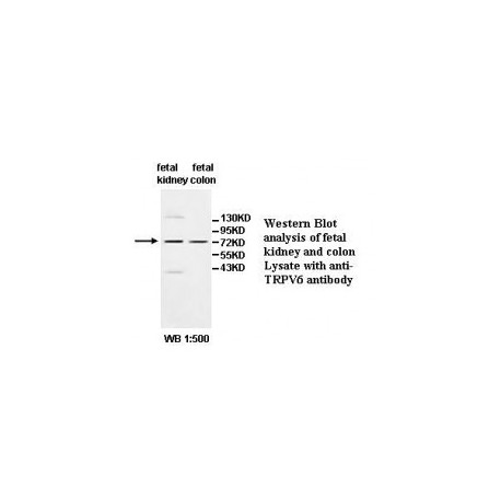 ALMS1 Antibody