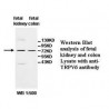 TRPV6 Antibody