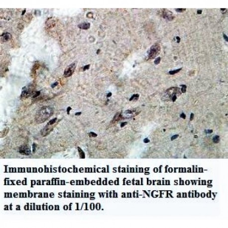 NGFR Antibody