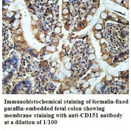 CD151 Antibody