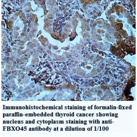 FBXO45 Antibody