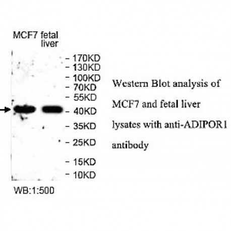 ADIPOR1 Antibody