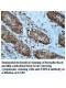 USP14 Antibody